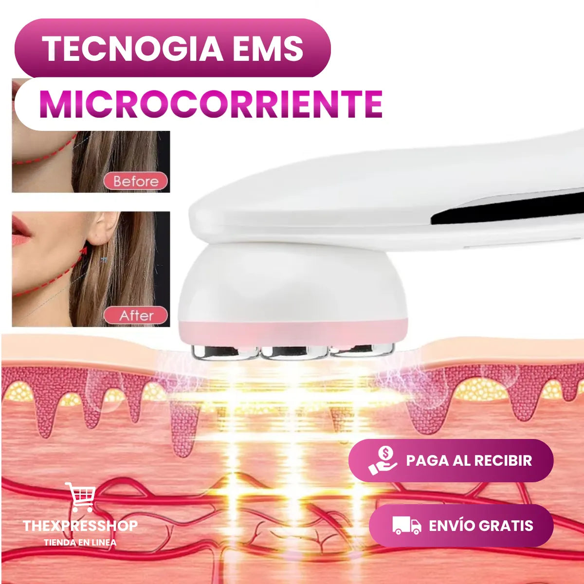 Electroporación Radiofrecuencia Facial - ANTIENVEJECIMIENTO